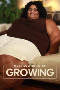 My Legs Won T Stop Growing S E Watch Full Episode Online Directv